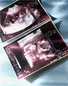 Double image of an ultrasound