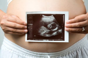 woman holding a fetal ultrasound image
