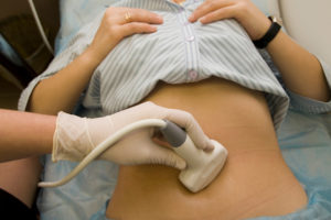 women receiving an ultrasound