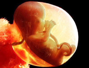 16 week unborn baby